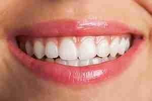 Tratamientos dentales clinic