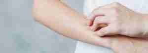 mano arrascandose el brazo. Dermatólogo en Léon