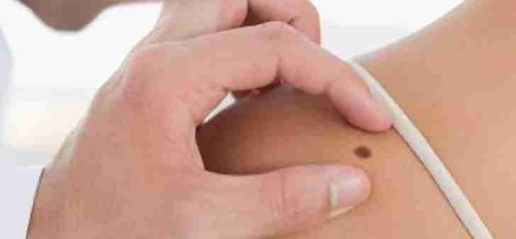 Consulta de dermatología en Wellness Clínic León